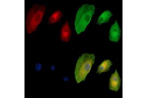 ABIN7095071 and ABIN7099127 staining  cells by IF/ICC. (TTPA anticorps)