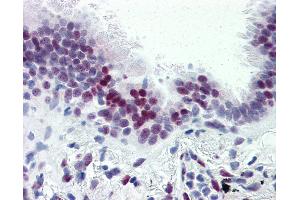 Anti-CASZ1 antibody IHC of human lung. (CASZ1 anticorps  (N-Term))