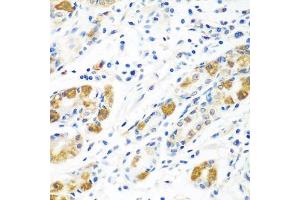 Immunohistochemistry of paraffin-embedded human stomach using BLVRB antibody. (BLVRB anticorps  (AA 1-206))