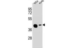 Western Blotting (WB) image for anti-Solute Carrier Family 35, Member G5 (SLC35G5) antibody (ABIN2995904) (AMAC1L2 anticorps)