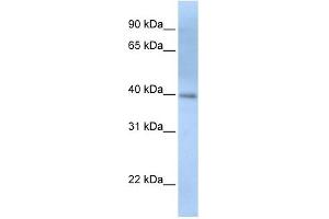 ITPK1 antibody used at 1 ug/ml to detect target protein. (ITPK1 anticorps  (N-Term))