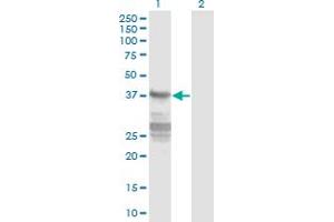 Western Blot analysis of CNN3 expression in transfected 293T cell line by CNN3 monoclonal antibody (M01), clone 4C4. (CNN3 anticorps  (AA 1-329))