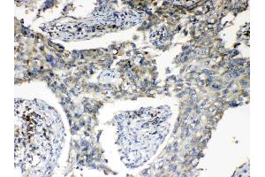 IHC analysis of RPS6 using anti- RPS6 antibody .
