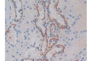 Detection of MET in Human Kidney Tissue using Polyclonal Antibody to C-Met (MET) (c-MET anticorps  (AA 1092-1379))