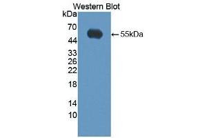 Detection of Recombinant KLK14, Human using Polyclonal Antibody to Kallikrein 14 (KLK14) (Kallikrein 14 anticorps  (AA 36-267))