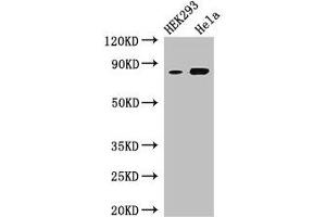 Western Blot Positive WB detected in: HEK293 whole cell lysate, Hela whole cell lysate All lanes: MELTF antibody at 3 μg/mL Secondary Goat polyclonal to rabbit IgG at 1/50000 dilution Predicted band size: 81, 33 kDa Observed band size: 81 kDa (MFI2 anticorps  (AA 20-302))