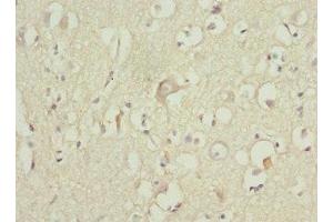 Immunohistochemistry of paraffin-embedded human brain tissue using ABIN7176117 at dilution of 1:100 (ZNF148 anticorps  (AA 690-794))