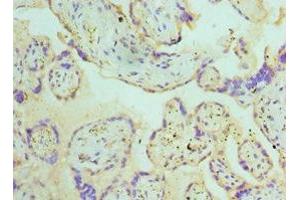 Immunohistochemistry of paraffin-embedded human placenta tissue using ABIN7145108 at dilution of 1:100 (ATG16L1 anticorps  (AA 90-300))