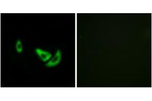 Immunofluorescence analysis of A549 cells, using DCT Antibody. (DCT anticorps  (AA 51-100))