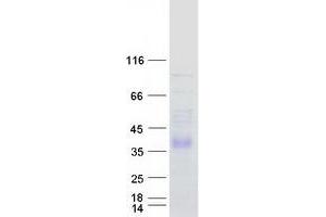 Validation with Western Blot