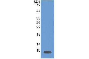 WB of Protein Standard: different control antibodies  against Highly purified E.