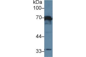Detection of IL1R1 in Rat Lung lysate using Polyclonal Antibody to Interleukin 1 Receptor Type I (IL1R1)