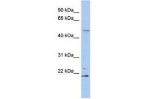 Image no. 1 for anti-Retinoblastoma Binding Protein 9 (RBBP9) (N-Term) antibody (ABIN6742511)