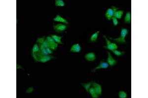 Immunofluorescence staining of MCF-7 cells with ABIN7162048 at 1:330, counter-stained with DAPI. (NME1 anticorps  (AA 2-152))