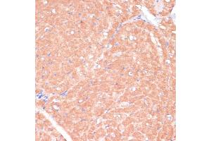 Immunohistochemistry of paraffin-embedded mouse heart using C antibody (ABIN7266010) at dilution of 1:100 (40x lens).