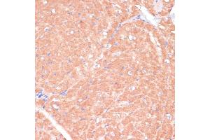 Immunohistochemistry of paraffin-embedded mouse heart using C antibody (ABIN7266010) at dilution of 1:100 (40x lens). (CACNB2 anticorps  (AA 481-660))