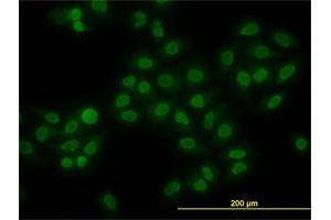 Immunofluorescence of monoclonal antibody to HMGB1 on HeLa cell. (HMGB1 anticorps  (AA 1-90))