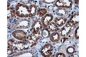 Immunohistochemical staining of paraffin-embedded Carcinoma of thyroid tissue using anti-RC219453 mouse monoclonal antibody. (NPR3 anticorps)