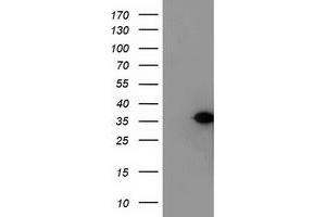 Western Blotting (WB) image for anti-Nucleotide Binding Protein-Like (NUBPL) (AA 1-250) antibody (ABIN1490634) (NUBPL anticorps  (AA 1-250))