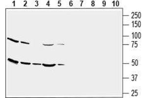 Western blot analysis of human U-87 MG glioblastoma cell line lysate (lanes 1 and 6), human THP-1 monocytic leukemia cell line lysate (lanes 2 and 7), human SH-SY5Y neuroblastoma cell line lysate (lanes 3 and 8), human MEG-01 megakaryoblastic leukemia cell line lysate (lanes 4 and 9) and human Jurkat T-cell leukemia cell line lysate (lanes 5 and 10): - 1-5. (SLC2A3 anticorps  (1st Extracellular Loop))