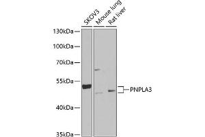 Western blot analysis of extracts of various cell lines, using PNPL Antibody (ABIN6132501, ABIN6145859, ABIN6145860 and ABIN6222404) at 1:1000 dilution. (PNPLA3 anticorps  (AA 377-481))