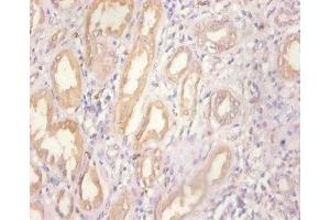 Immunohistochemistry of paraffin-embedded human kidney tissue using ABIN7159509 at dilution of 1:100 (MT1A anticorps  (AA 1-59))