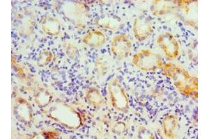 Immunohistochemistry of paraffin-embedded human kidney tissue using ABIN7154176 at dilution of 1:100 (GATM anticorps  (AA 124-423))