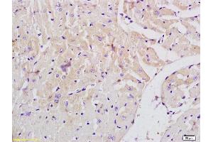 Formalin-fixed and paraffin embedded mouse heart labeled with Anti-MLK3/RHOE Polyclonal Antibody, Unconjugated (ABIN682573) at 1:200 followed by conjugation to the secondary antibody (MAP3K11 anticorps  (AA 355-460))