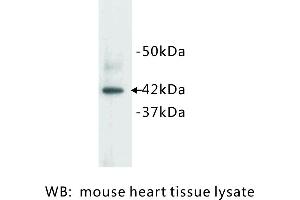 Image no. 1 for anti-Actin, Alpha, Cardiac Muscle 1 (ACTC1) antibody (ABIN1112792)
