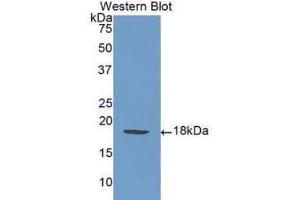 Western Blotting (WB) image for anti-Selectin P (Granule Membrane Protein 140kDa, Antigen CD62) (SELP) (AA 58-195) antibody (ABIN1078521) (P-Selectin anticorps  (AA 58-195))