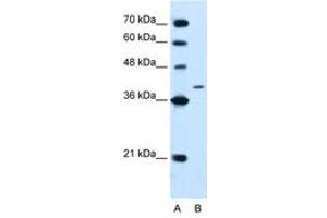 Image no. 1 for anti-Protein tyrosine Phosphatase, Non-Receptor Type 2 (PTPN2) (AA 23-72) antibody (ABIN205078)