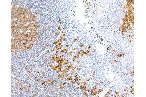 Immunohistochemistry (IHC) image for anti-CD38 (AA 43-300) antibody (ABIN7453961) (Recombinant CD38 anticorps  (AA 43-300))