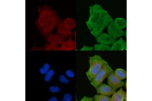 staining Hela cells(30 min of UV treatment) by IF/ICC. (PDE4B/C/D anticorps)