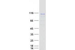 Validation with Western Blot