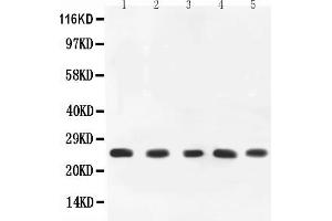 Anti-TNF alpha Picoband antibody, All lanes: Anti-TNF alpha at 0. (TNF alpha anticorps  (AA 89-235))