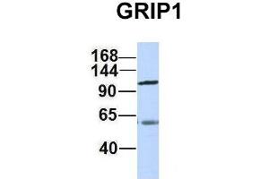 Host:  Rabbit  Target Name:  GRIP1  Sample Type:  Human Adult Placenta  Antibody Dilution:  1. (GRIP1 anticorps  (C-Term))