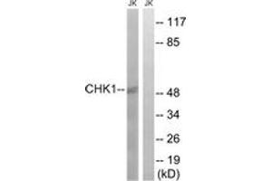 Western blot analysis of extracts from JurKat cells, using Chk1 (Ab-280) Antibody. (CHEK1 anticorps  (AA 251-300))