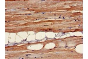 Immunohistochemistry of paraffin-embedded human skeletal muscle tissue using ABIN7145371 at dilution of 1:100
