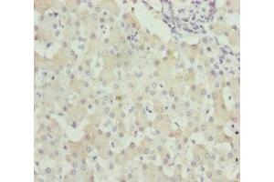 Immunohistochemistry of paraffin-embedded human liver tissue using ABIN7175709 at dilution of 1:100 (WDR45 anticorps  (AA 1-360))