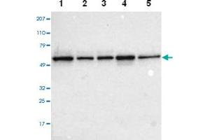 Western blot analysis of Lane 1: RT-4, Lane 2: EFO-21, Lane 3: A-431, Lane 4: Liver, Lane 5: Tonsil with TOM1 polyclonal antibody . (TOM1 anticorps)