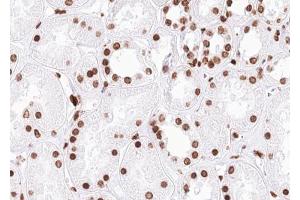 ABIN6267648 at 1/100 staining human kidney tissue sections by IHC-P. (SMC1A anticorps  (pSer957))