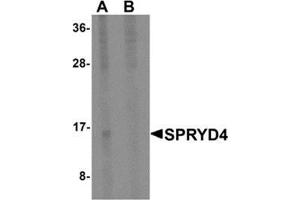 Western blot analysis of SPRYD4 in mouse kidney tissue lysate with SPRYD4 antibody at 1 μg/ml in (A) the absence and (B) the presence of blocking peptide. (SPRYD4 anticorps  (Center))