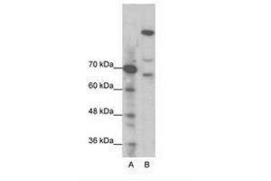 Image no. 1 for anti-Zinc Finger Protein GLI1 (GLI1) (N-Term) antibody (ABIN202973) (GLI1 anticorps  (N-Term))