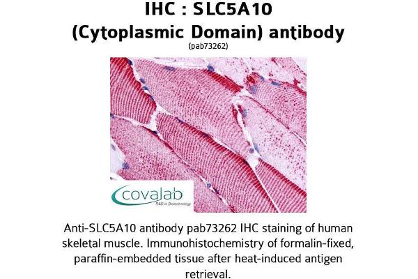 SLC5A10 anticorps  (Cytoplasmic Domain)