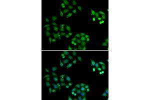 Immunofluorescence analysis of HeLa cells using NSFL1C antibody (ABIN5974024). (NSFL1C anticorps)