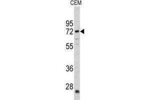 Western Blotting (WB) image for anti-Carnitine O-Acetyltransferase (CRAT) antibody (ABIN3002687) (CRAT anticorps)