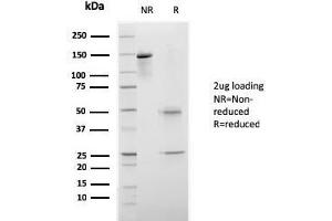 SDS-PAGE Analysis Purified CELA3B Recombinant Mouse Monoclonal Antibody (rCELA3B/1811). (Recombinant Elastase 3B anticorps  (AA 82-238))