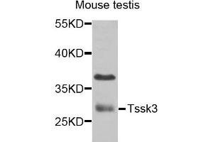 Western blot analysis of extracts of mouse testis cells, using TSSK3 antibody.