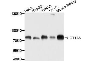 Western blot analysis of extracts of various cells, using UGT1A6 antibody. (UGT1A6 anticorps)