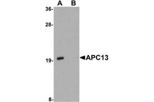 Western blot analysis of APC13 in Jurkat cell tissue lysate with APC13 antibody at 1 μg/ml in (A) the absence and (B) the presence of blocking peptide.